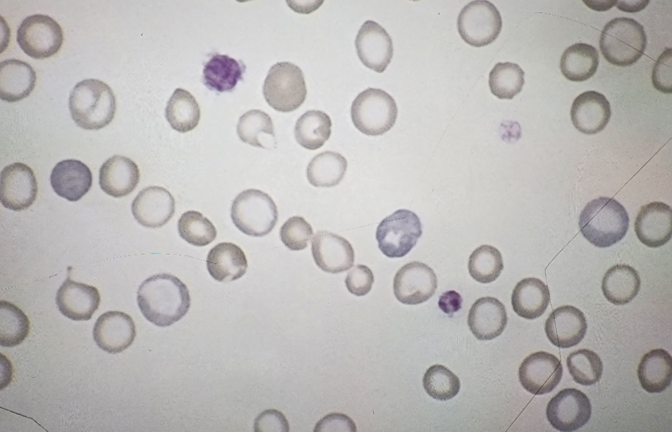 <p>RBCs with less color</p>