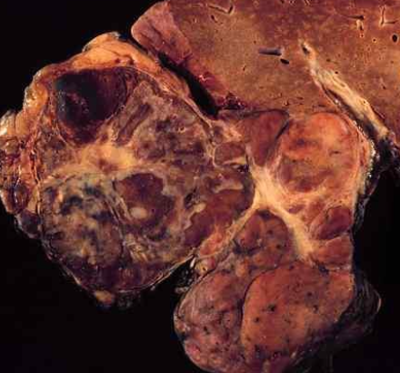 <p>liver, dose-dependent, acute</p>