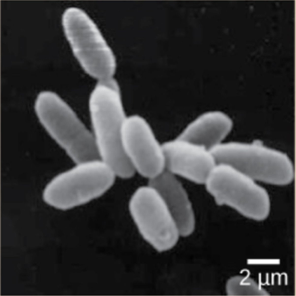 <p>methanogens</p><p>(Note: produced as</p><p>a by-product of</p><p>obtaining energy</p><p>from H2 to fix CO2)</p>