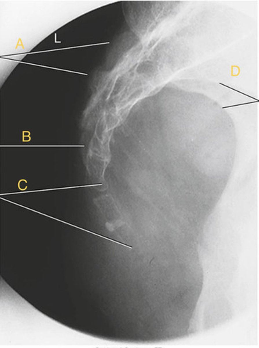 <p>What position?</p>