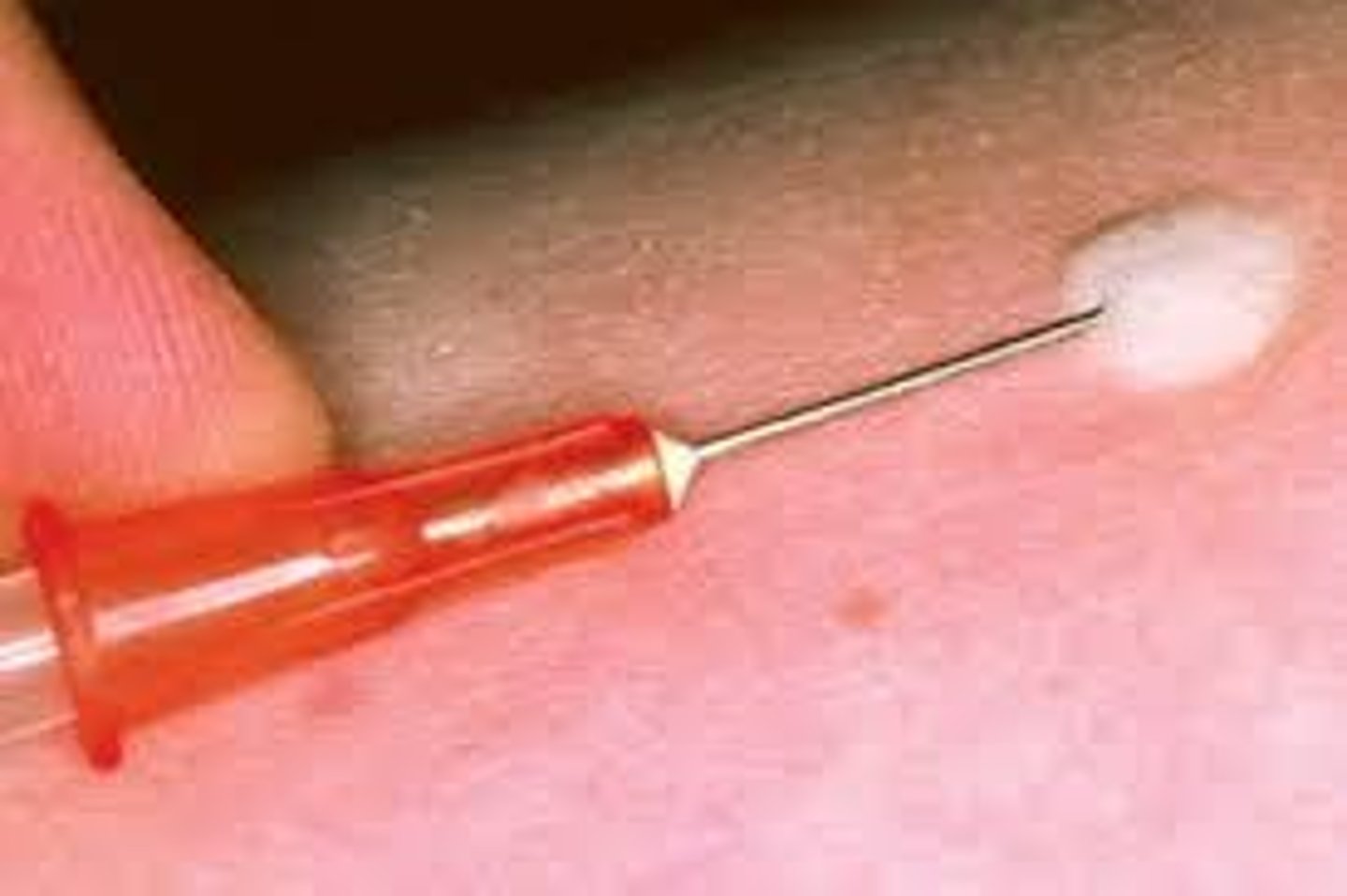 <p>Vitamin K is necessary for blood clotting and is routinely administered intramuscularly.</p>