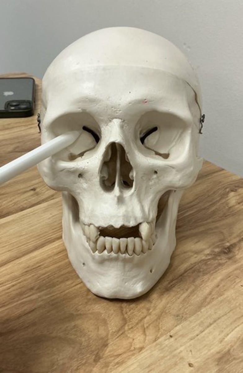 <p>What bone is this?</p>