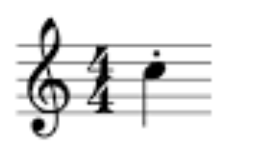 <p>play the note short and detached; space between notes</p>