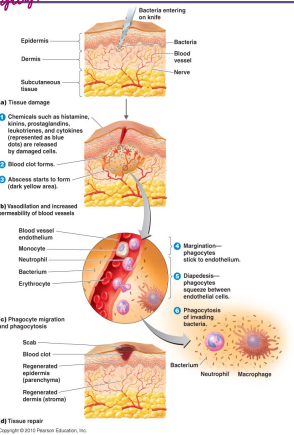 <ul><li><p>signs and symptoms</p><ul><li><p>pain</p></li><li><p>redness</p></li><li><p>heat</p></li><li><p>swelling</p></li><li><p>loss of function</p></li></ul></li><li><p>inflammation functions to destroy an injurious agent</p></li><li><p>it also acts to prevent the spreading of an injurious agent</p></li><li><p>it repairs and replaces damage tissues</p></li></ul><p>its a procedure → stop spread of bad guy</p><p>eliminate spread → kill in end (keep it local and deal with it)</p><p></p>