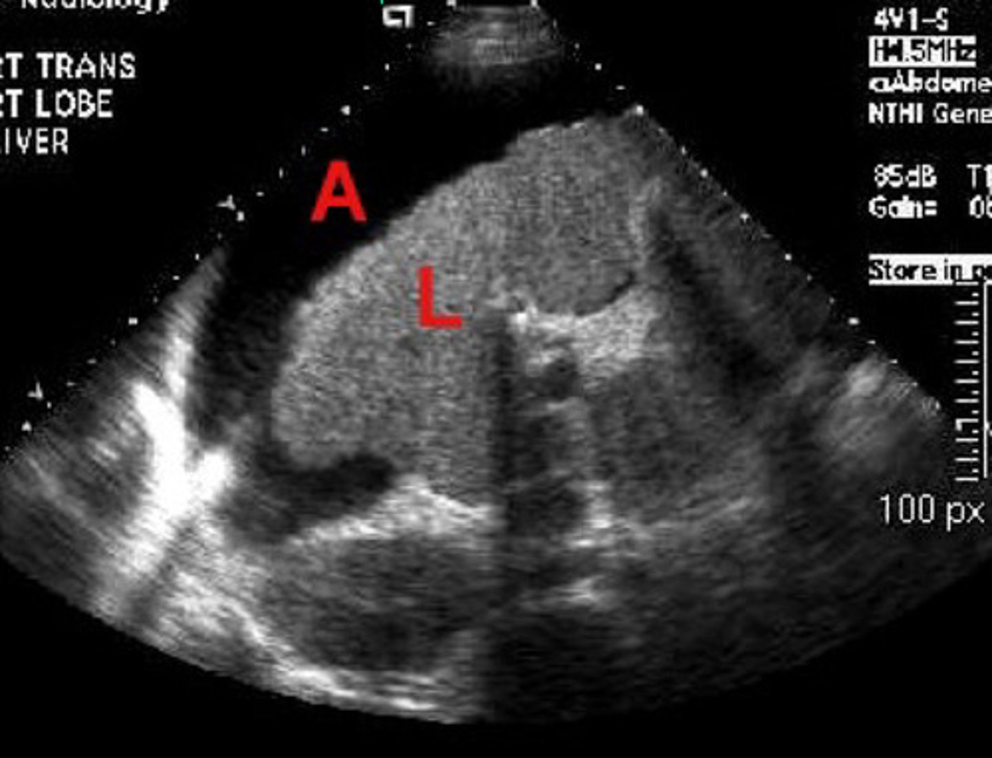 <p>What is going on here? Is this normal or abnormal?</p>