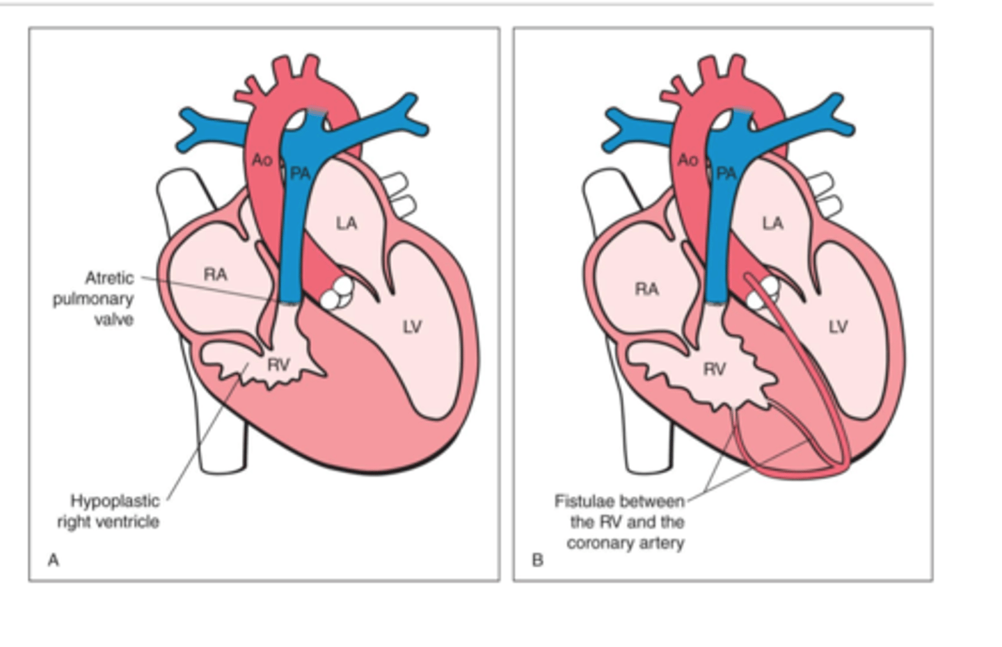 <p>Child relies on ASD for survival</p>