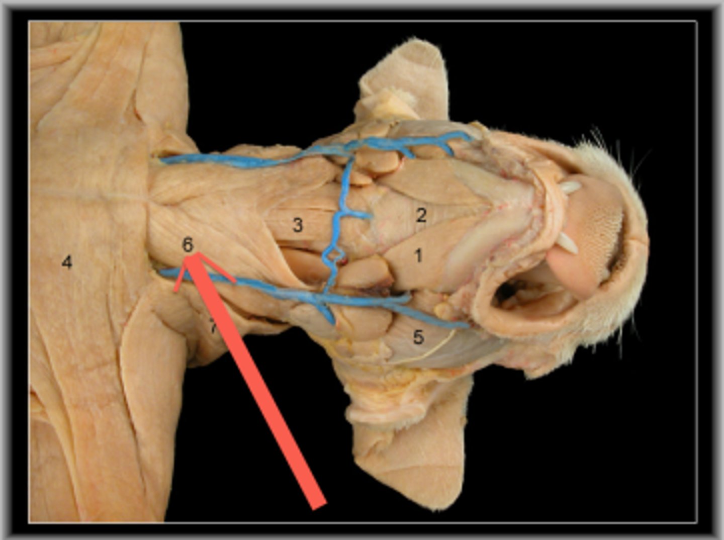 <p>name this muscle</p>