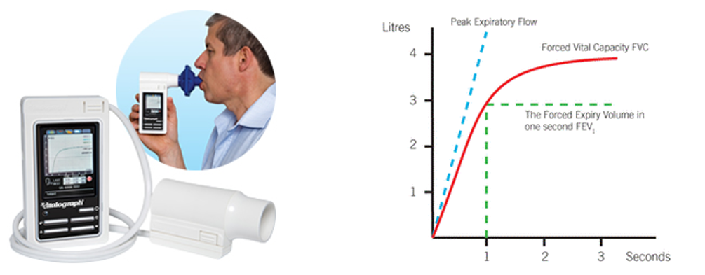 <p>Produces graph of the amount of air breathed out and how quickly. FEV<sub>1</sub> = Forced expiratory volume in one second ( How much air is forced out in one second)</p>