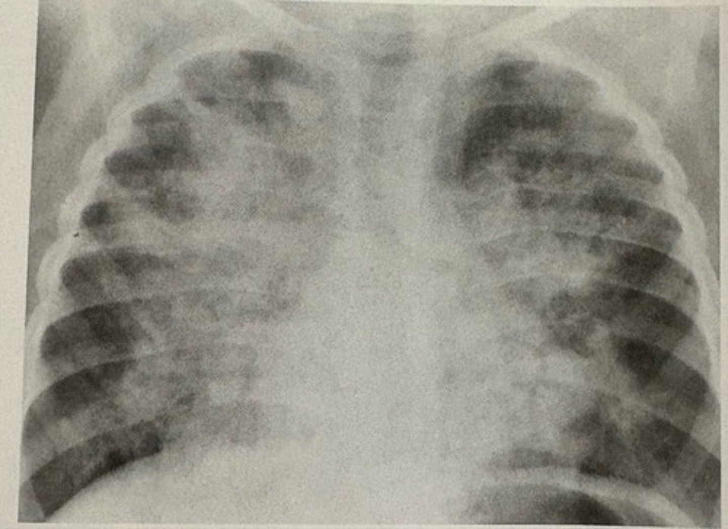 <p>what pathology is present?</p>