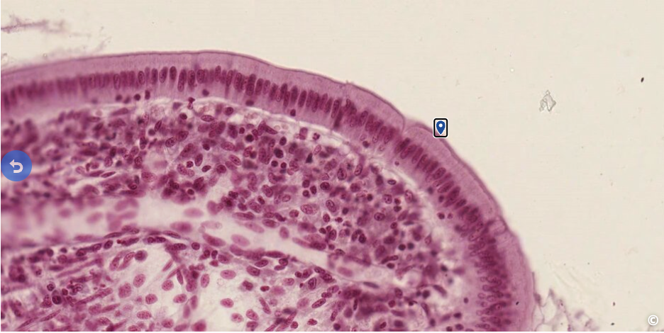 <p>identify the surface specialization</p>