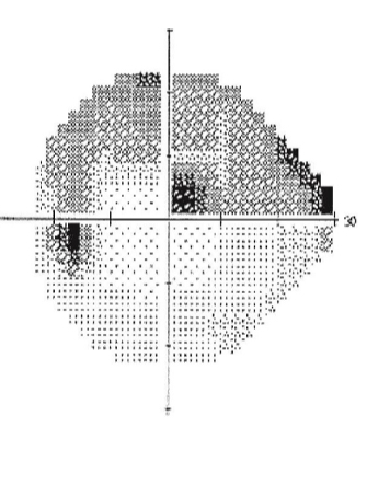 <p>What kind of defect is this</p>