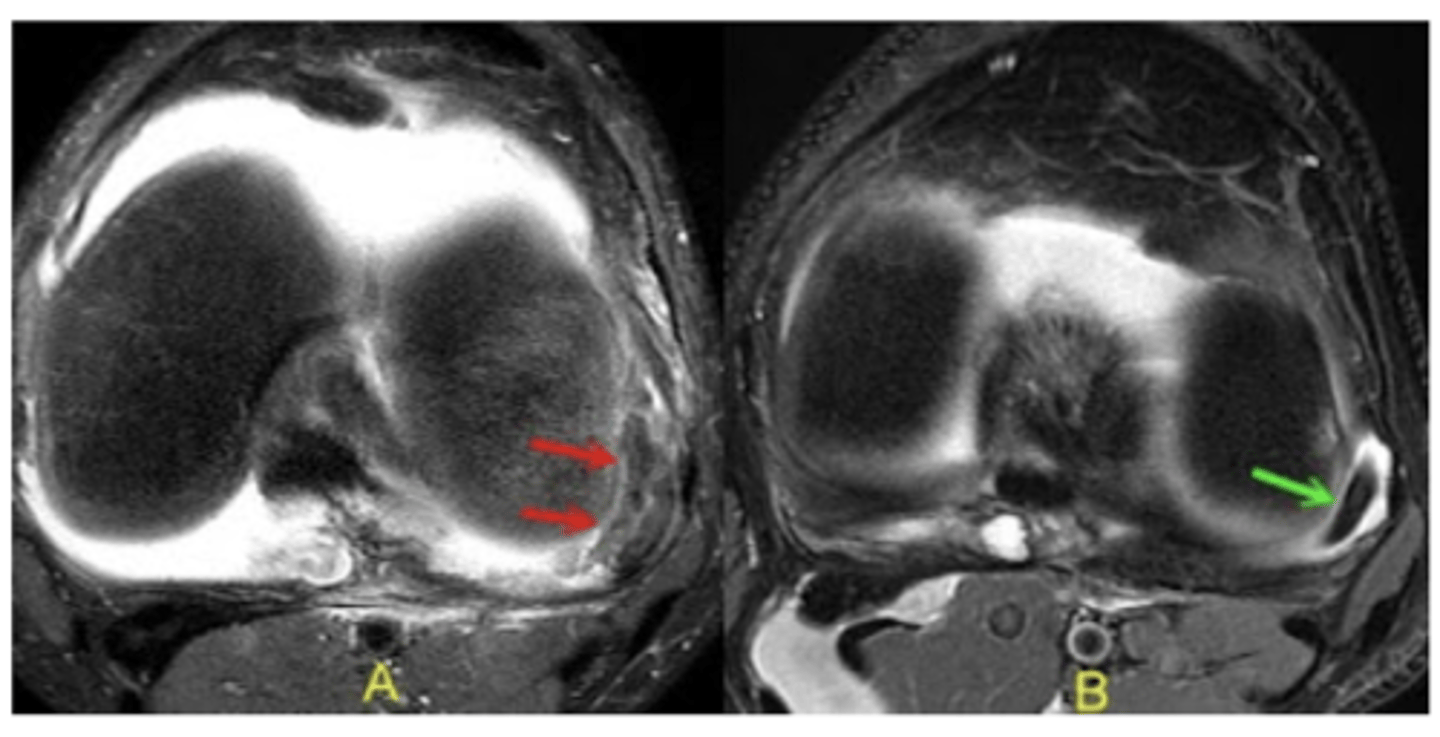 <p>Define the pathology.</p>