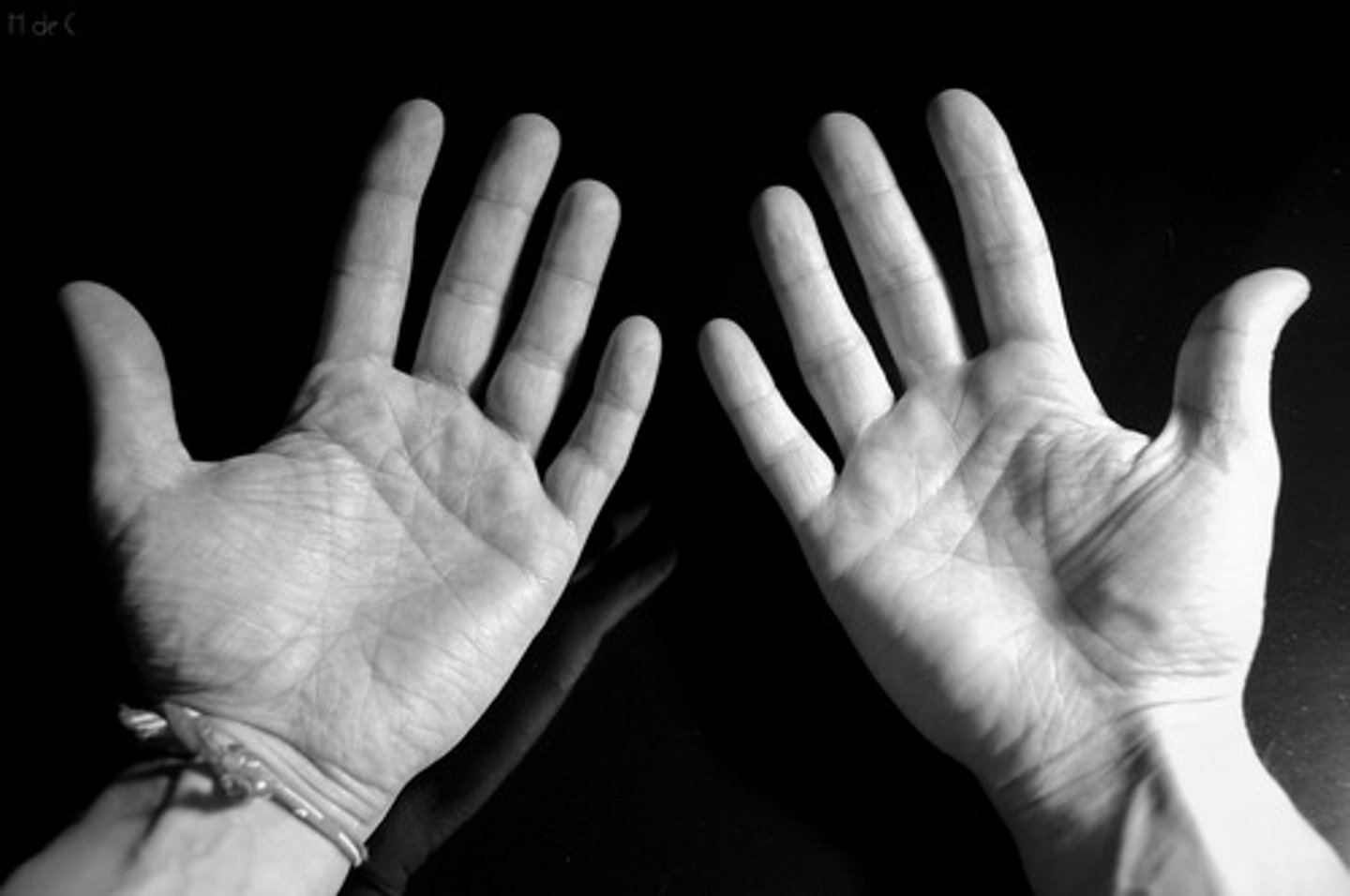 <p>Palm of hand</p>