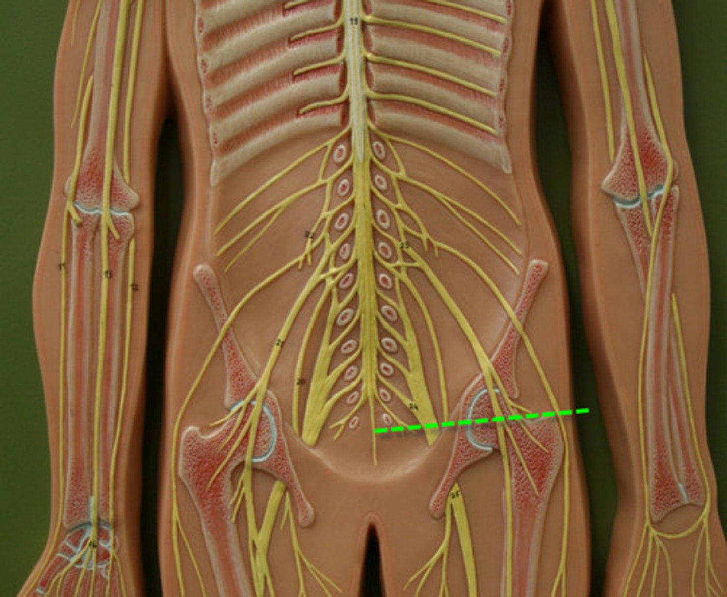 <p>Thin strand of fibrous tissue that extends from the conus medullaris and anchors the spinal cord</p>