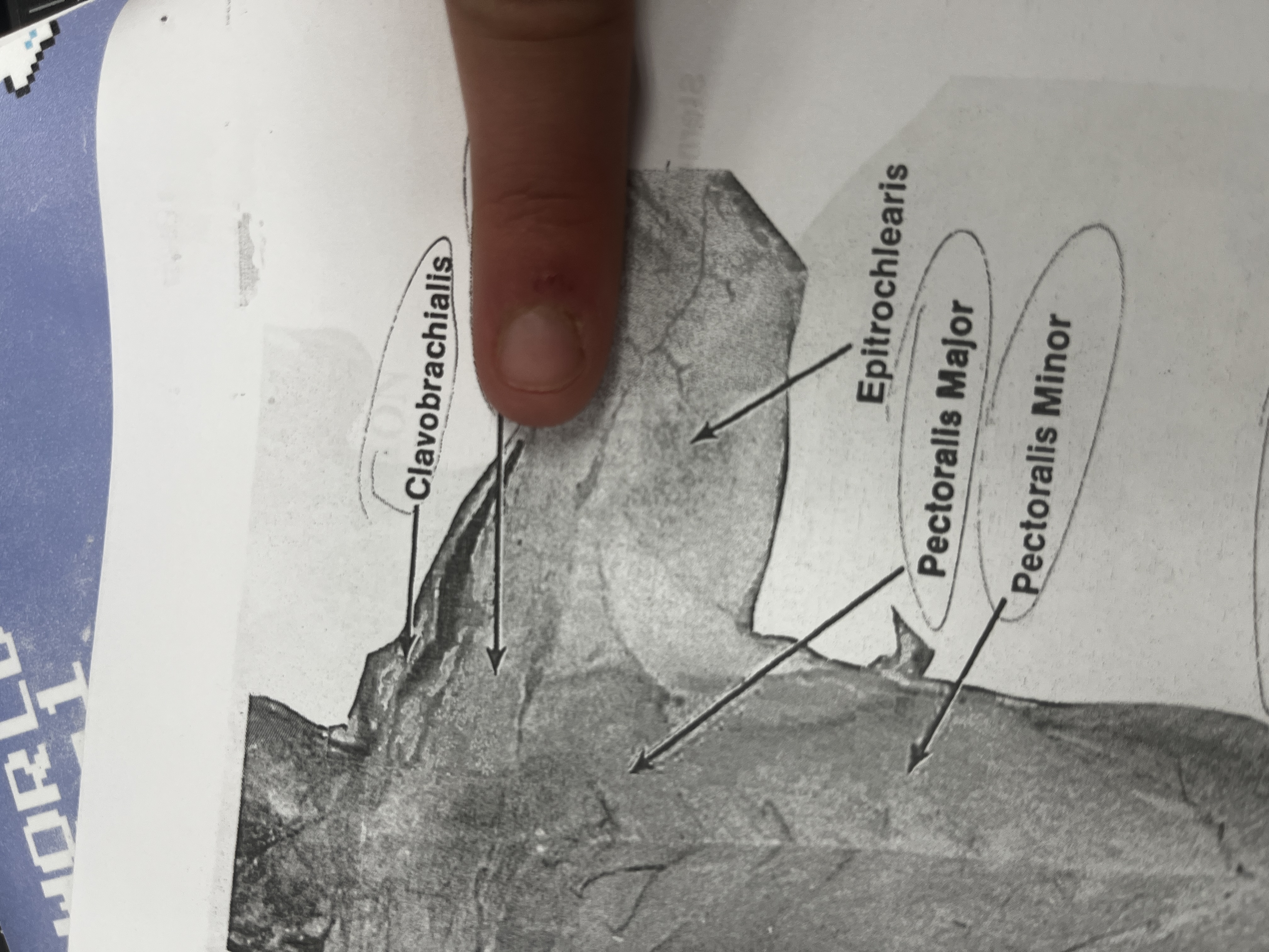<p>A thin muscle in the chest that assists in the movement of the forelimb.</p>