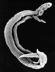 <p>Trematoda</p>