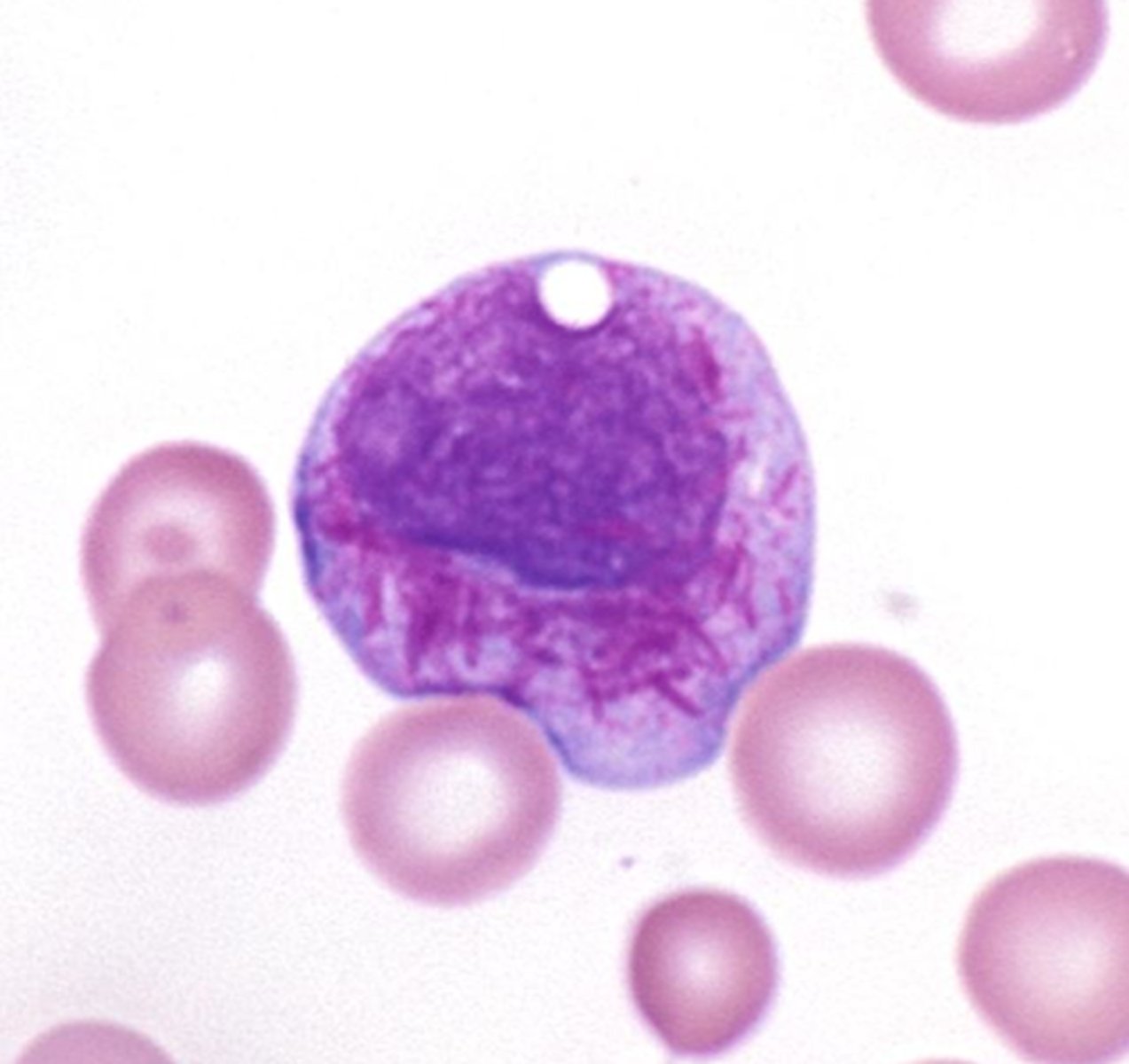 <p>- Needle-shaped rods</p><p>- Red-purple inclusions</p><p>- Found in leukemic myeloblasts &amp; promyelocytes</p><p>- Made of fused lysosomes, peroxidase and lysosomal enzymes</p>