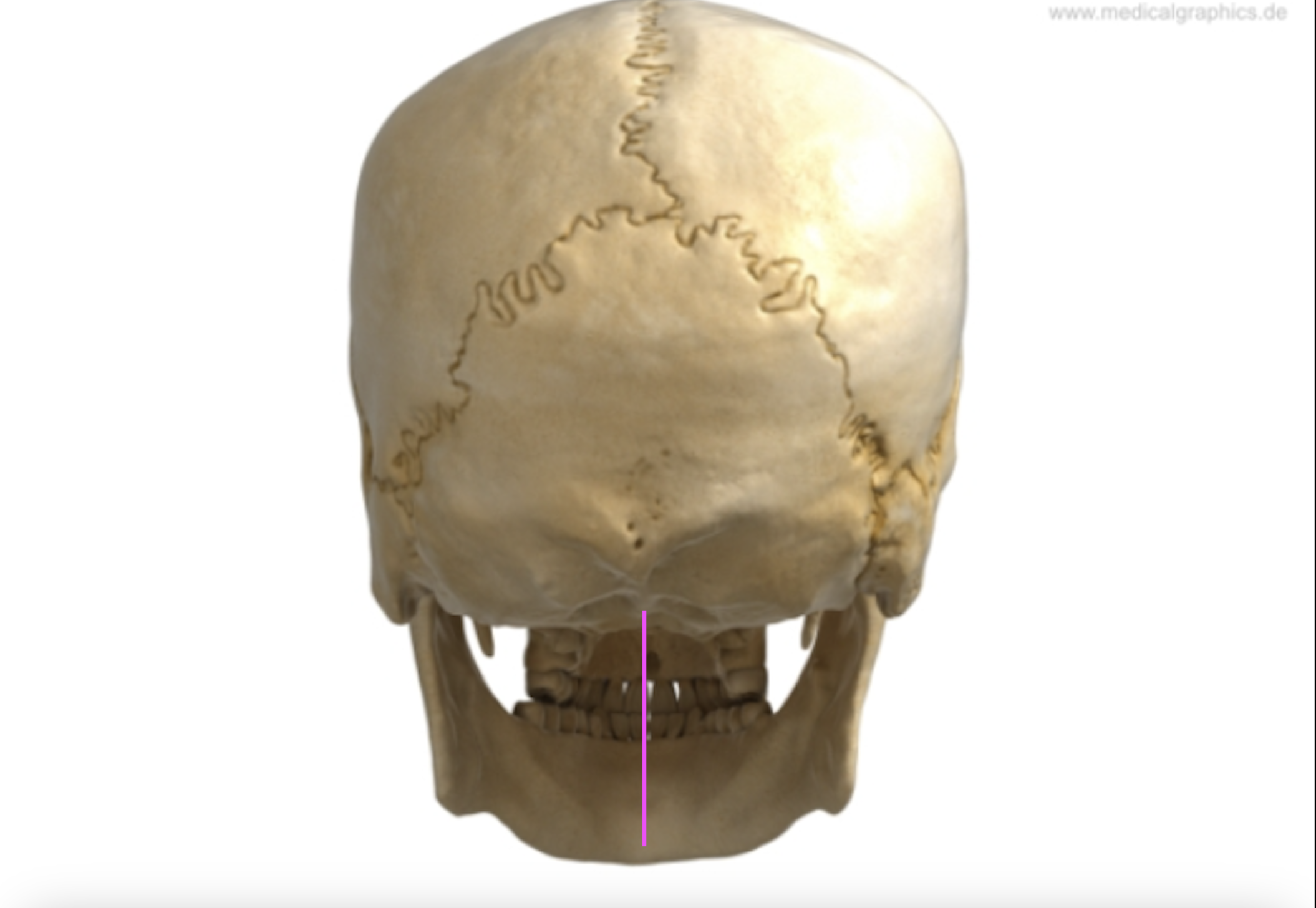 <p>What bone marking is this?</p>