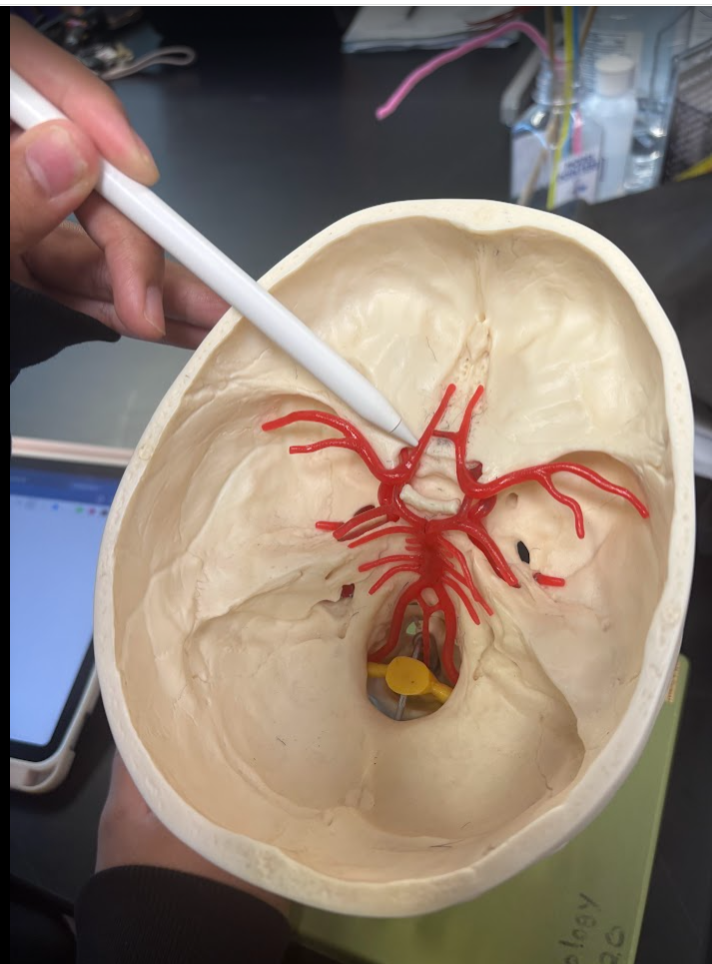 <p>Anterior cerebral artery</p>