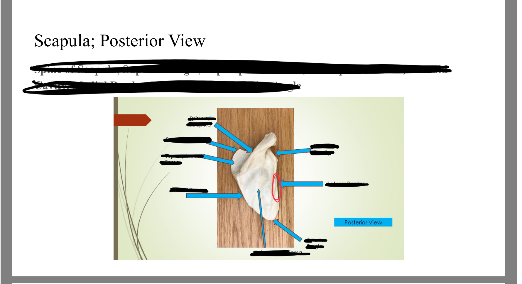 <p>Lateral border</p>