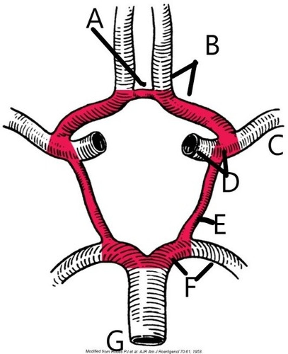 <p>The structure labeled "B" is:</p><p>A. Anterior Cerebral Artery</p><p>B. Posterior Cerebral Artery</p><p>C. Posterior Communicating Artery</p><p>D. Anterior Inferior Cerebellar Artery</p><p>3 multiple choice options</p>