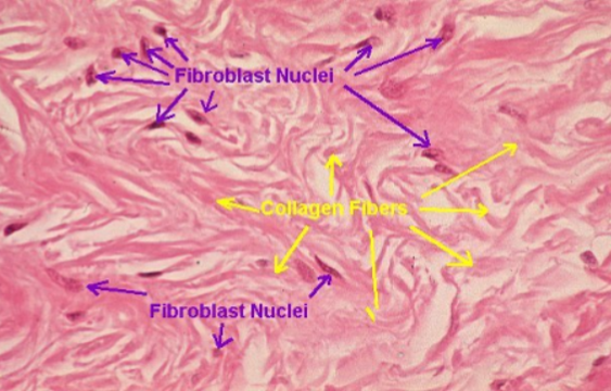 <p>Has a high amount of closely packed collagen fibers which makes it strong and able to resist stretching &amp; it provides support and connects different tissues in the body </p>