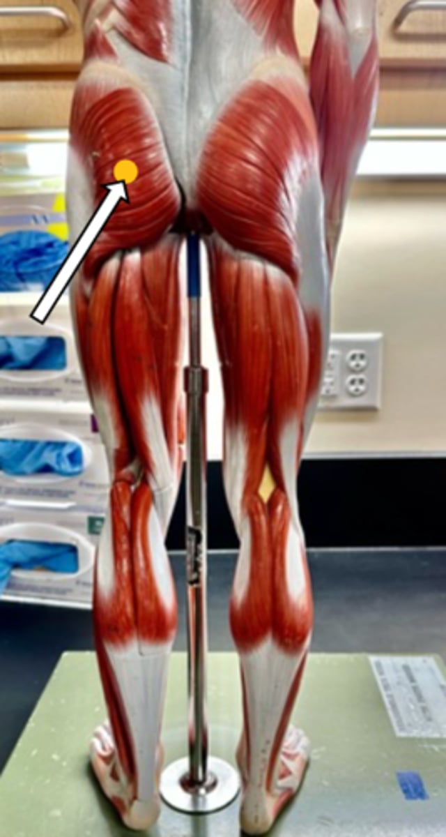 <p>gluteus maximus (function)</p>