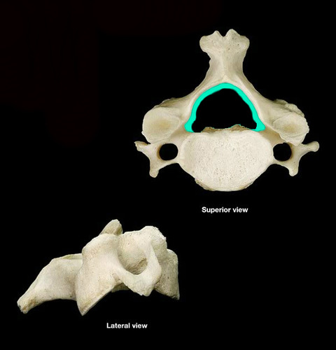 A circle of bone around the canal through which the spinal cord passes.