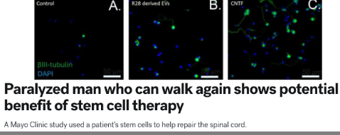 <p>what are the embryonic stem cells?</p>