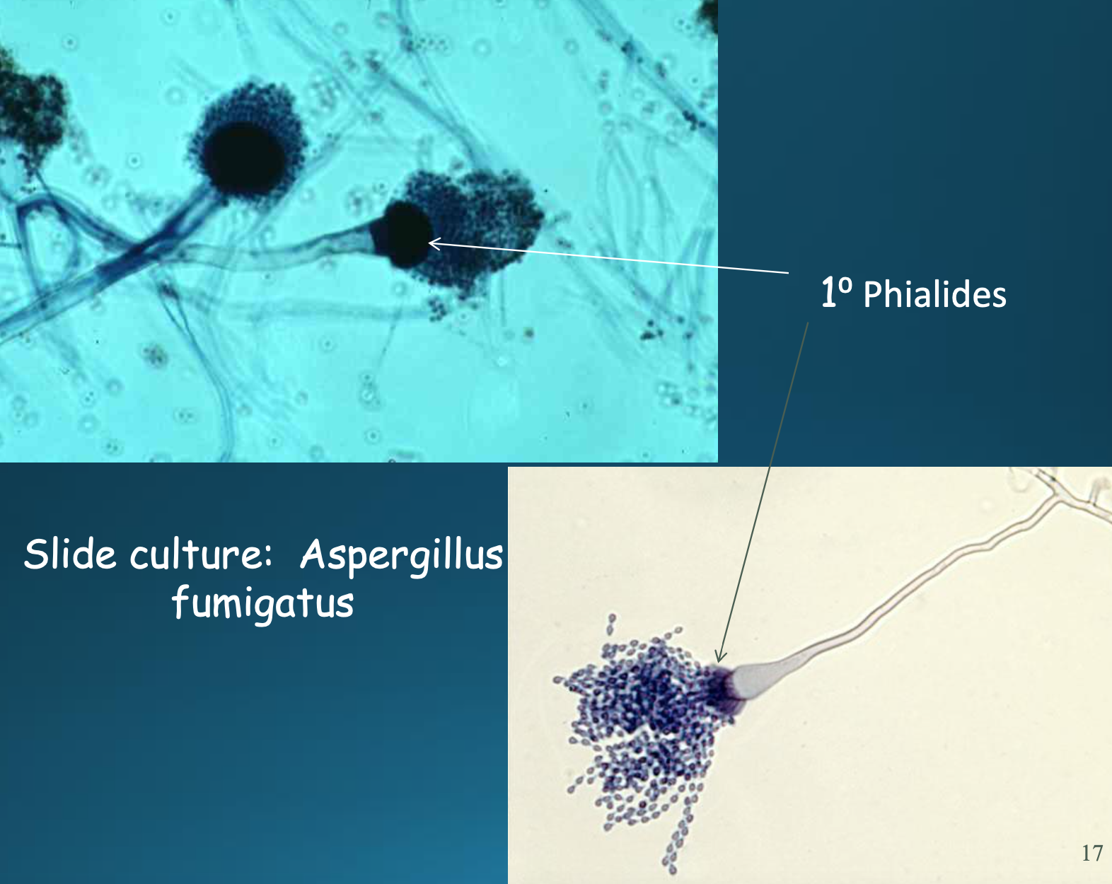 <p>Aspergillus fumigatus microscopically and macroscopically</p>