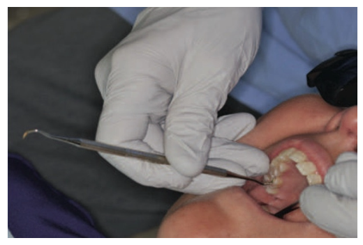 <p>To steady the hand during operating procedures.</p>