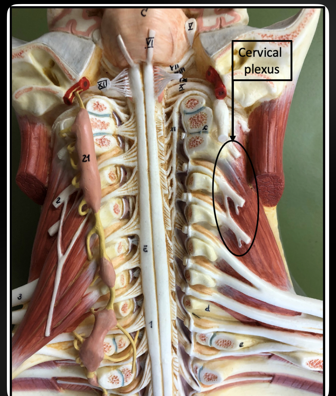 <p>Cervical Plexus</p>