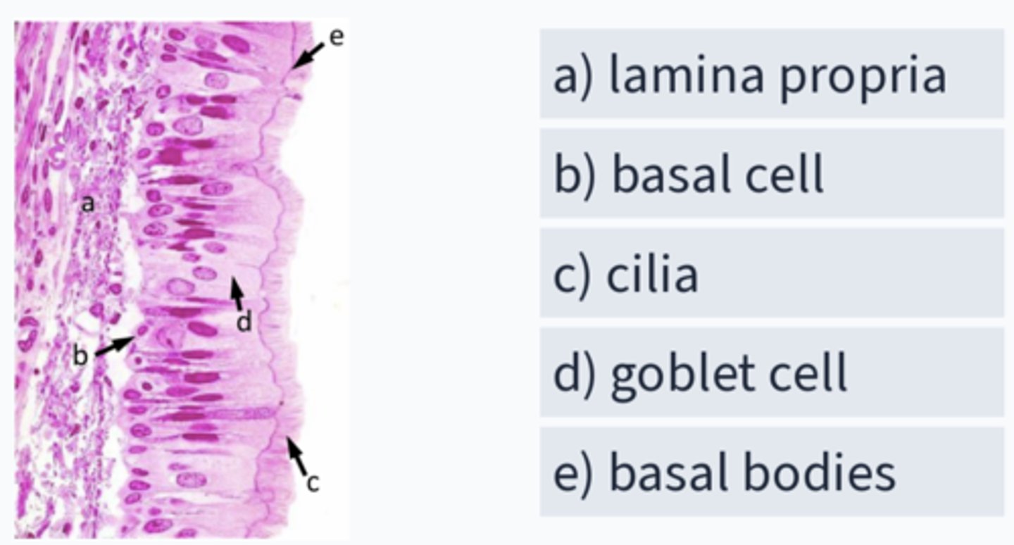 <p>Which is mislabeled?</p>