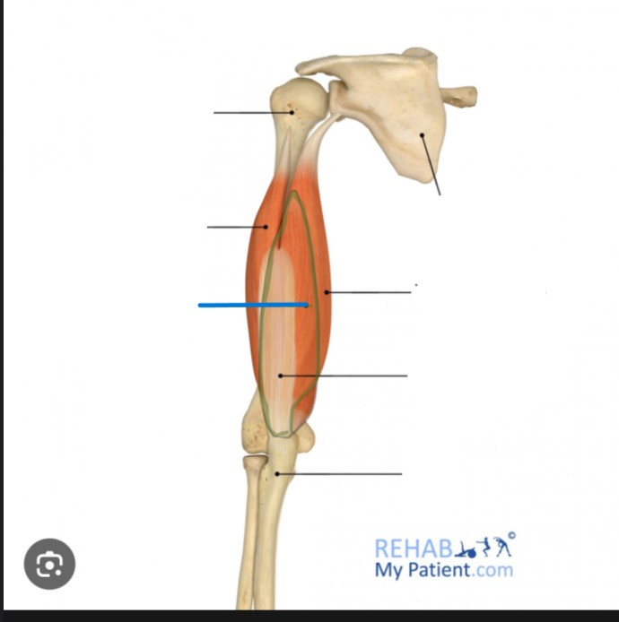 <p>Identify the highlighted muscle</p>