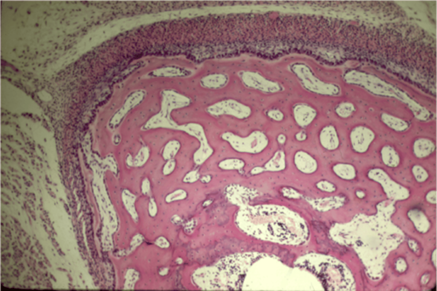 <p>spongy bone</p>