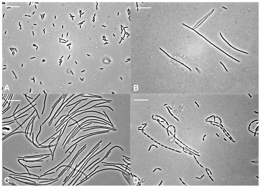<p>Filamentous Helical (Virus Shape) </p>