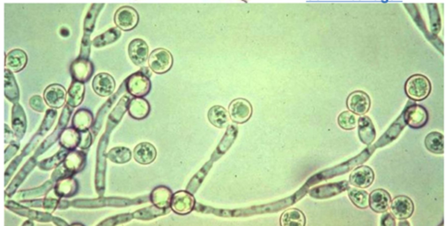 <p>what medium was this Candida albicans isolated on?</p>