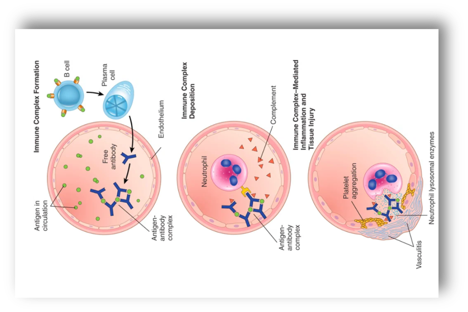 <p>mechanism of immune complex-mediated diseases→ immune complex forms: antibodies are secreted in blood, they react with antigens and antigen-antibody complex forms, immune complex deposits: antigen-antibody complexes are deposited in various tissues, immune complex-mediated inflammation and tissue injury: clinical manifestations occur about 10 days after antigen gets into blood </p>