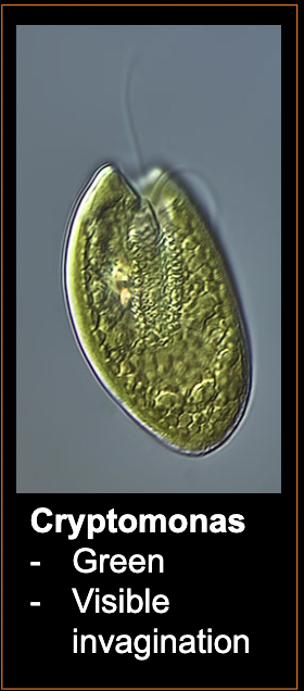 <p>What bacteria is this?</p>