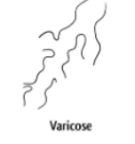 <ul><li><p>dilated segments with areas of constriction.</p></li></ul><p></p>