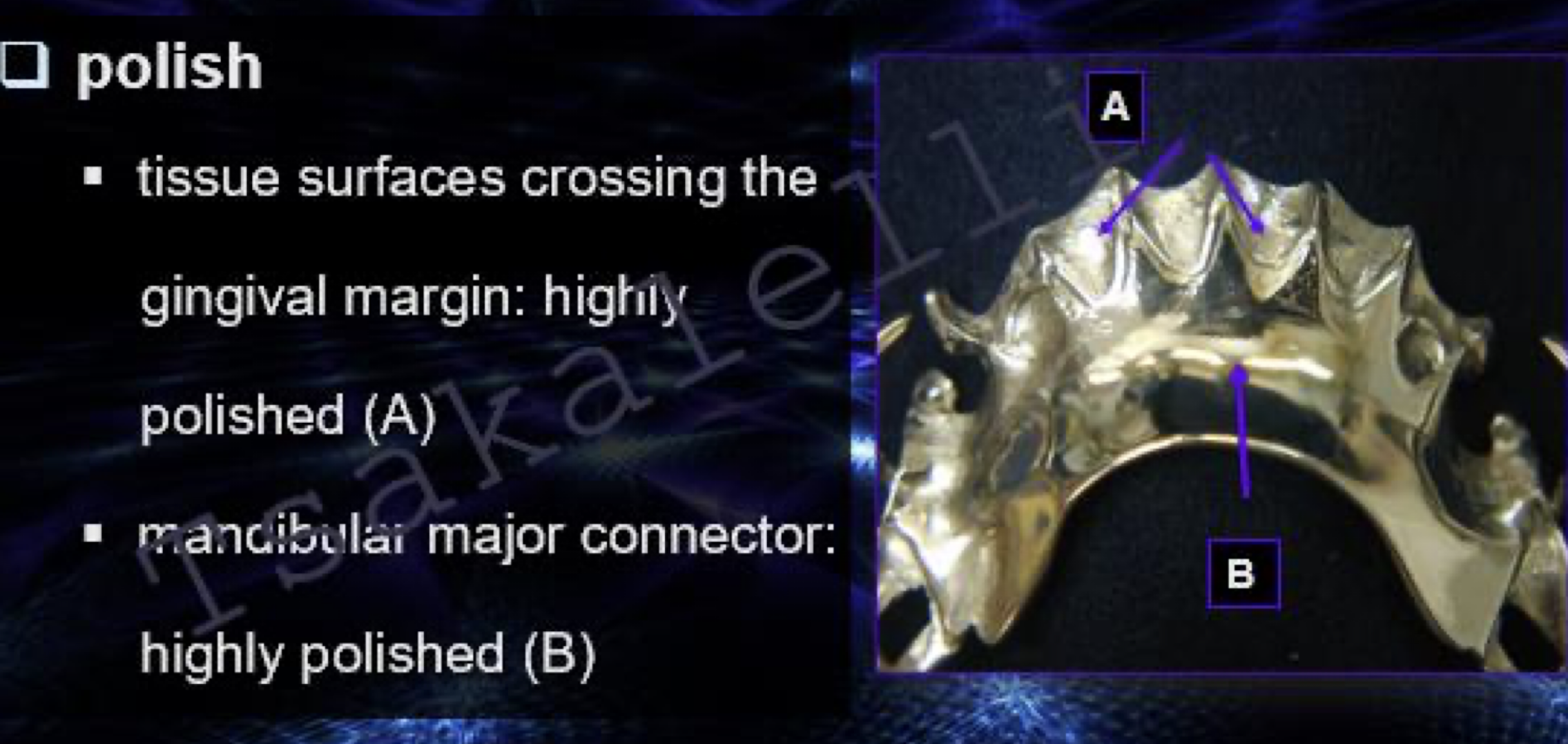<ul><li><p>tissue surfaces crossing the gingival margin</p></li><li><p>mandibular major connector </p></li></ul><p></p>