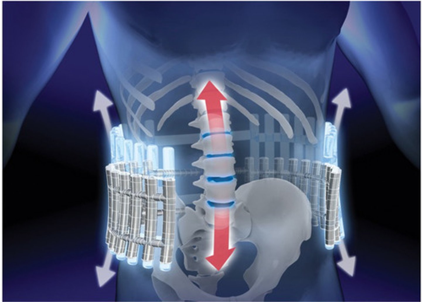 <p>circumferential compression over the waist</p>