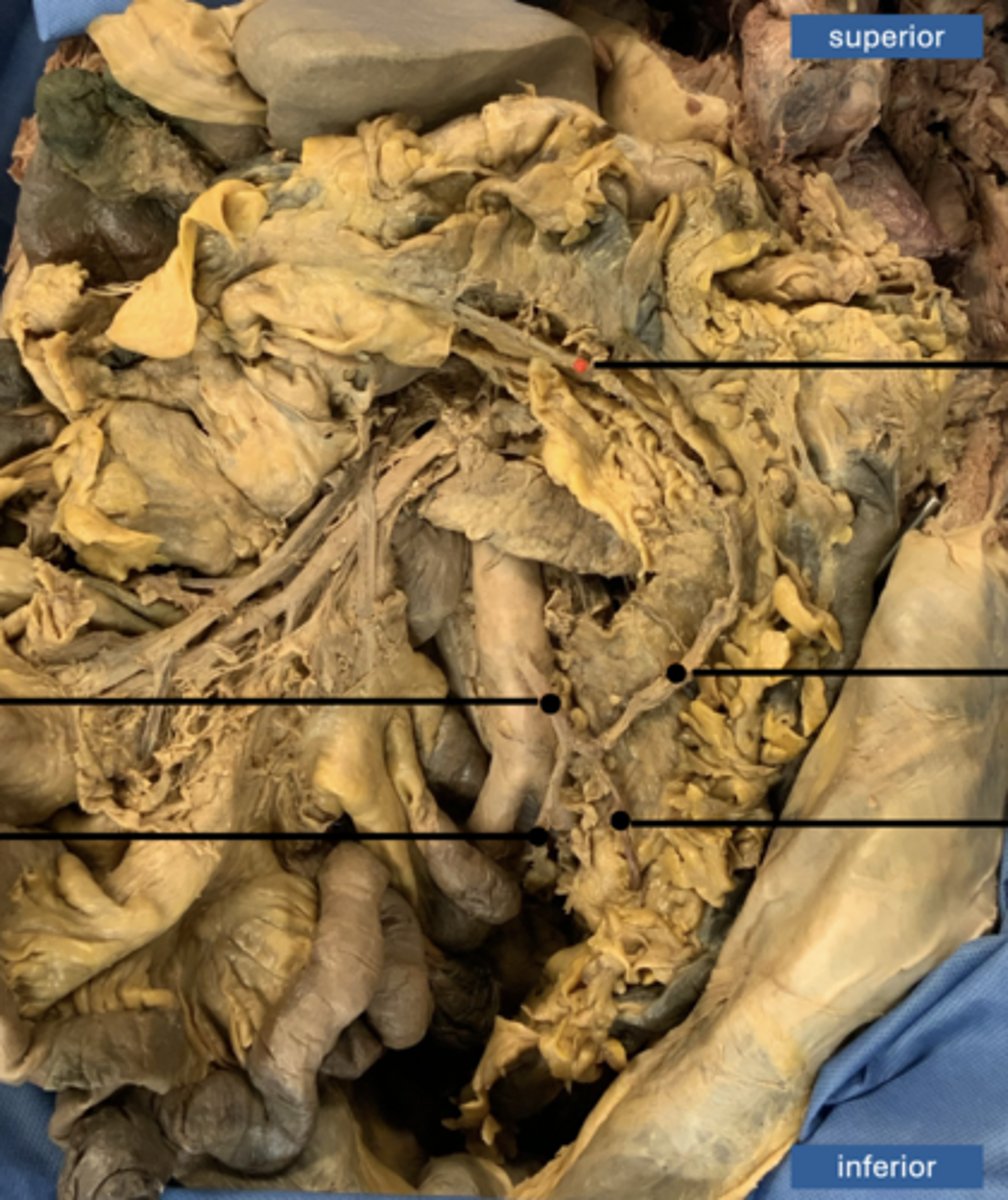 <p>artery</p>