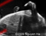 <ol><li><p>Is this image of the arms normal or abnormal?</p></li><li><p>If abnormal, what pathology is seen here?</p></li></ol><p></p>