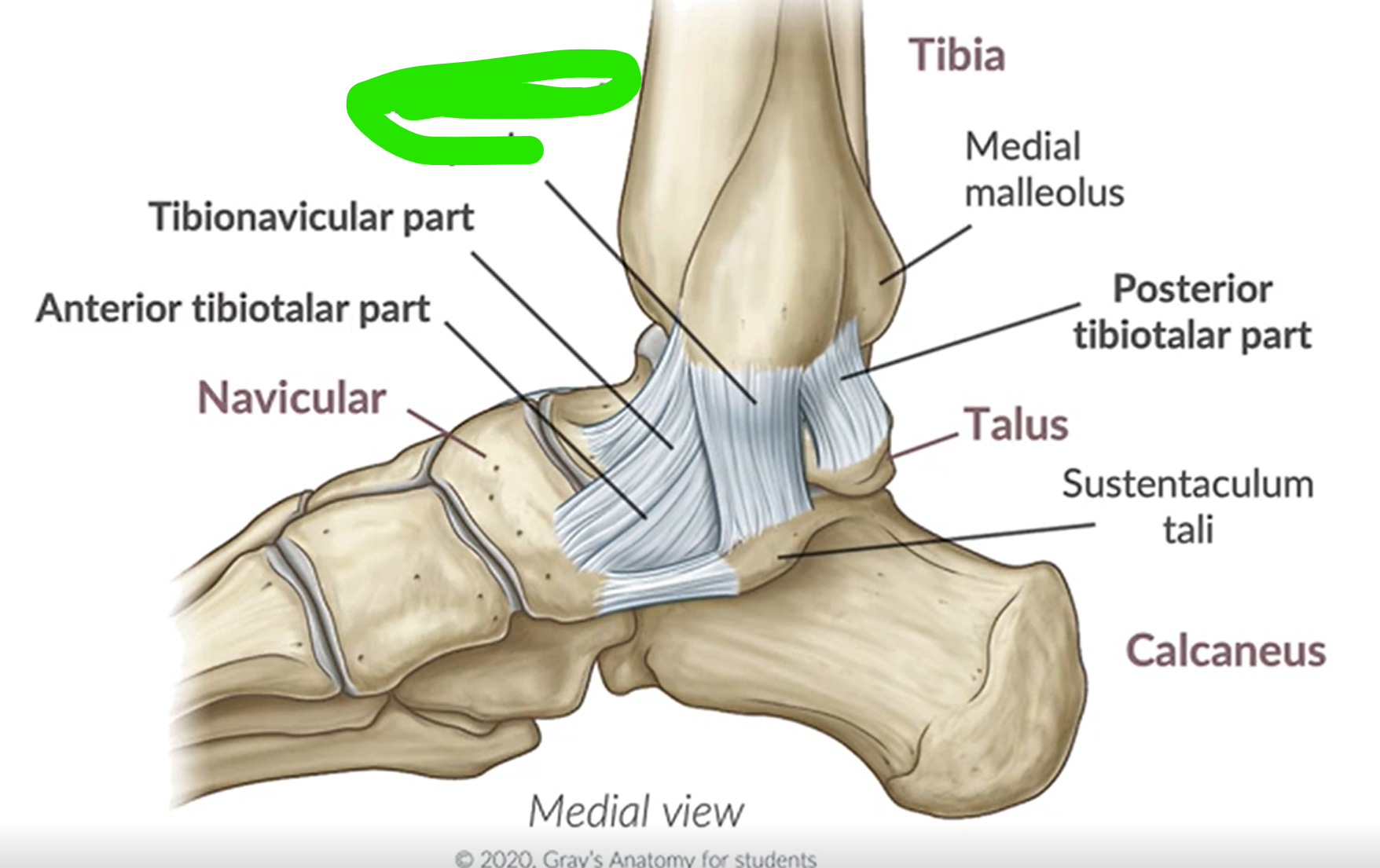 term image