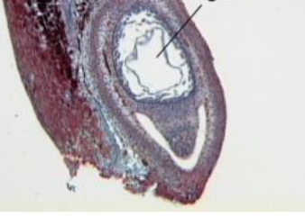 <p>identify stage of female gametophyte development</p>