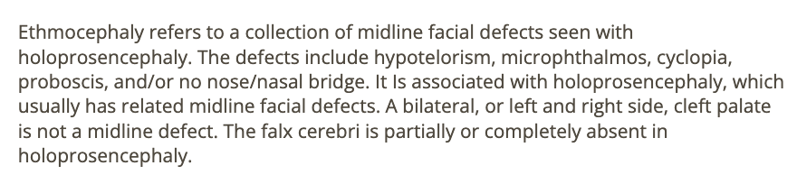 <p>b) ethmocephaly</p>