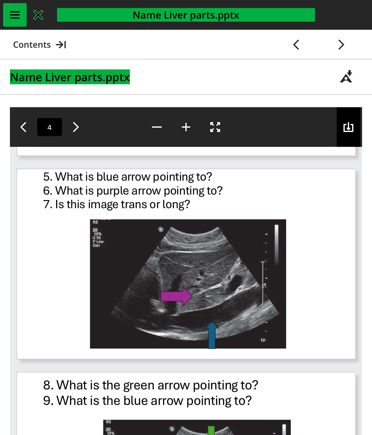 <ol start="5"><li><p>what is the blue arrow pointing to </p></li></ol>