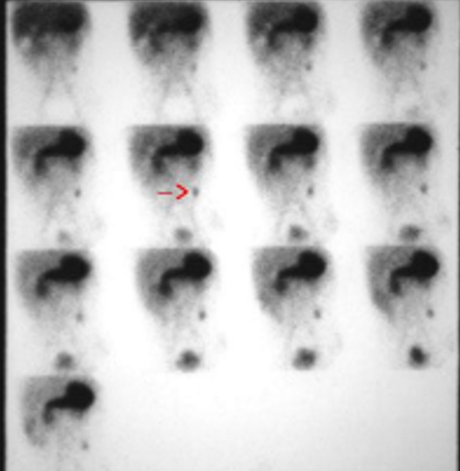 term image