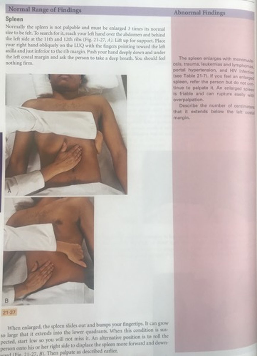 <p>D</p><p>If an enlarged spleen is felt, then the nurse should refer the person and should not continue to palpate it. An enlarged spleen is friable and can easily rupture with overpalpation.</p>